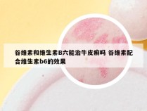 谷维素和维生素B六能治牛皮癣吗 谷维素配合维生素b6的效果