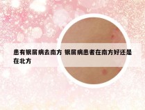 患有银屑病去南方 银屑病患者在南方好还是在北方