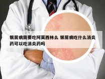 银屑病需要吃阿莫西林么 银屑病吃什么消炎药可以吃消炎药吗