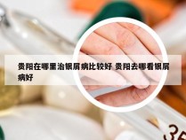 贵阳在哪里治银屑病比较好 贵阳去哪看银屑病好