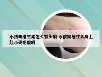 小孩缺维生素怎么有头癣 小孩缺维生素身上起小硬疙瘩吗