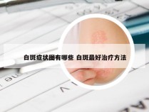 白斑症状图有哪些 白斑最好治疗方法