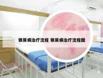 银屑病治疗流程 银屑病治疗流程图