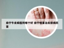 南宁牛皮癣医院哪个好 南宁哪里治皮肤病厉害