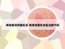 蝎毒癣净抑菌乳膏 蝎毒抑菌乳膏能治脚气吗