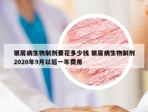银屑病生物制剂要花多少钱 银屑病生物制剂2020年9月以后一年费用