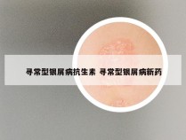 寻常型银屑病抗生素 寻常型银屑病新药