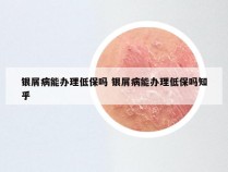 银屑病能办理低保吗 银屑病能办理低保吗知乎