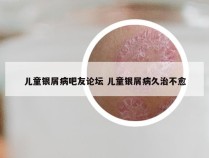 儿童银屑病吧友论坛 儿童银屑病久治不愈