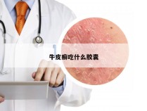 牛皮癣吃什么胶囊