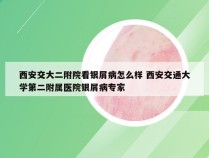 西安交大二附院看银屑病怎么样 西安交通大学第二附属医院银屑病专家