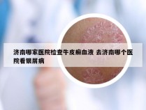 济南哪家医院检查牛皮癣血液 去济南哪个医院看银屑病