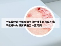 甲氨蝶呤治疗银屑病手指肿痛多久可以不痛 甲氨蝶呤对银屑病是否一直用药