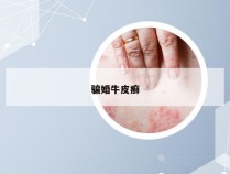 骗婚牛皮癣