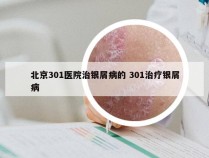 北京301医院治银屑病的 301治疗银屑病