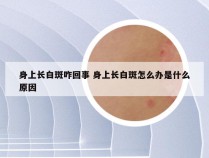 身上长白斑咋回事 身上长白斑怎么办是什么原因