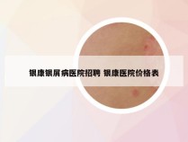 银康银屑病医院招聘 银康医院价格表
