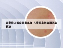 儿童脸上长白斑怎么办 儿童脸上长白斑怎么解决