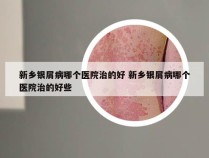 新乡银屑病哪个医院治的好 新乡银屑病哪个医院治的好些