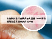 生物制剂治疗皮肤病纳入医保 2021生物制剂治疗皮肤病多少钱一支
