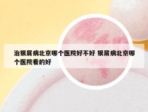 治银屑病北京哪个医院好不好 银屑病北京哪个医院看的好
