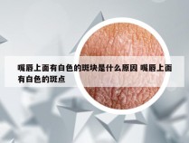 嘴唇上面有白色的斑块是什么原因 嘴唇上面有白色的斑点