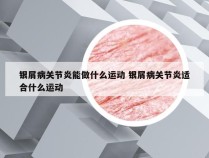 银屑病关节炎能做什么运动 银屑病关节炎适合什么运动