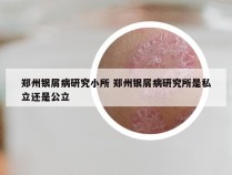 郑州银屑病研究小所 郑州银屑病研究所是私立还是公立