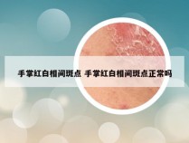 手掌红白相间斑点 手掌红白相间斑点正常吗