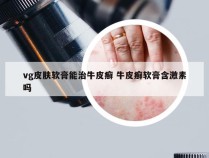 vg皮肤软膏能治牛皮癣 牛皮癣软膏含激素吗
