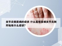 关节炎银屑病的症状 什么是银屑病关节炎刚开始有什么症状?