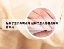 起癣了怎么办有点痒 起癣了怎么办有点痒用什么药
