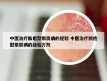 中医治疗脓疱型银屑病的经验 中医治疗脓疱型银屑病的经验方剂