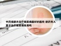 中药填脐方治疗银屑病最好的医院 脐药导入离子治疗银屑病有用吗