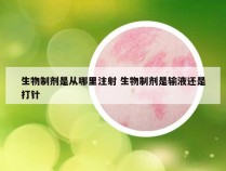 生物制剂是从哪里注射 生物制剂是输液还是打针