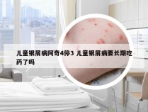 儿童银屑病阿奇4停3 儿童银屑病要长期吃药了吗