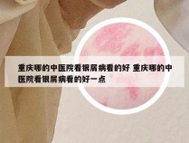 重庆哪的中医院看银屑病看的好 重庆哪的中医院看银屑病看的好一点