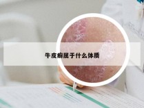 牛皮癣属于什么体质