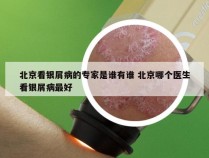 北京看银屑病的专家是谁有谁 北京哪个医生看银屑病最好