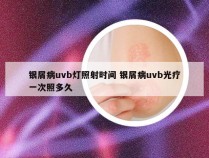 银屑病uvb灯照射时间 银屑病uvb光疗一次照多久