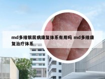 md多维银屑病康复体系有用吗 md多维康复治疗体系