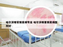 哈尔滨哪家银屑病专业 哈尔滨哪里银屑病医院好