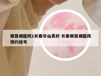 银屑病医院1长春华山真好 长春银屑病医院预约挂号