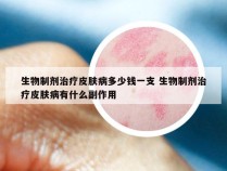 生物制剂治疗皮肤病多少钱一支 生物制剂治疗皮肤病有什么副作用