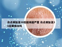 白点病加温30后越来越严重 白点病加温30后要换水吗