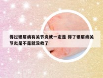 得过银屑病有关节炎就一定是 得了银屑病关节炎是不是就没救了