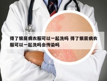 得了银屑病衣服可以一起洗吗 得了银屑病衣服可以一起洗吗会传染吗
