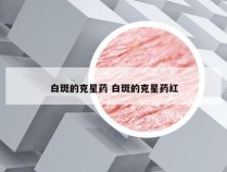 白斑的克星药 白斑的克星药红