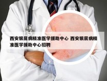 西安银屑病精准医学援助中心 西安银屑病精准医学援助中心招聘