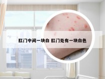 肛门中间一块白 肛门处有一块白色